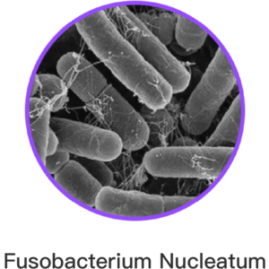 Fusobacterium Nucleatum